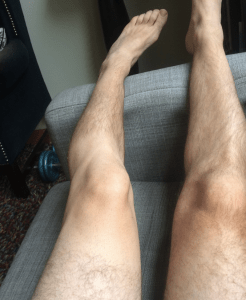 Hmm. Maybe Shane Warne should start doing dodgy hair-restoration adverts for knees? 